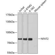 Western blot analysis of extracts of various cell lines using NFAT2 Antibody (1/3000 dilution).