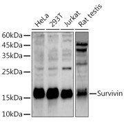 Western blot analysis of various lysates using Survivin Antibody (1/500 dilution).