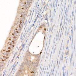 Baculoviral IAP Repeat-Containing Protein 5 (BIRC5) Antibody