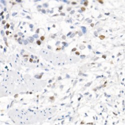 Baculoviral IAP Repeat-Containing Protein 5 (BIRC5) Antibody