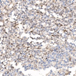 Baculoviral IAP Repeat-Containing Protein 5 (BIRC5) Antibody
