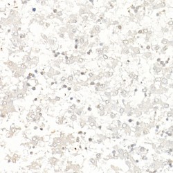 Baculoviral IAP Repeat-Containing Protein 5 (BIRC5) Antibody