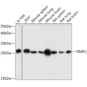 Western blot analysis of extracts of various cell lines using TIMP2 Antibody (1/1000 dilution).
