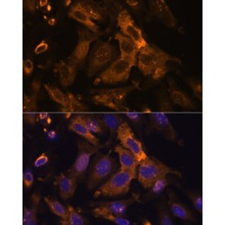 Metalloproteinase Inhibitor 2 (TIMP2) Antibody