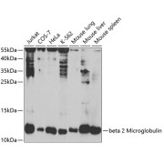 Western blot analysis of extracts of various cell lines using beta 2 Microglobulin Antibody (1/1000 dilution).