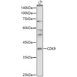 Cyclin-Dependent Kinase 9 (CDK9) Antibody