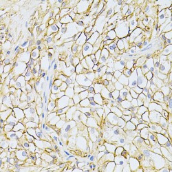 Basigin (BSG) Antibody