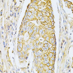 Basigin (BSG) Antibody