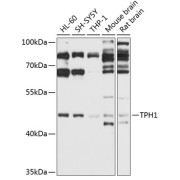 Western blot analysis of extracts of various cell lines using TPH1 Antibody (1/1000 dilution).