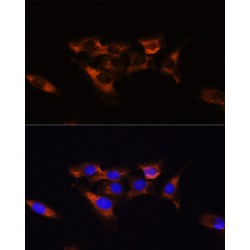 Adenosine A2a Receptor (ADORA2A) Antibody
