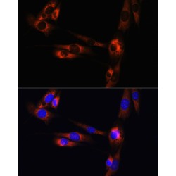 Adenosine A2a Receptor (ADORA2A) Antibody