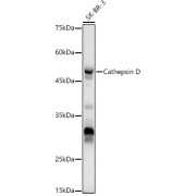 Western blot analysis of SK-BR-3 using CathepsinD Antibody (1/500 dilution).