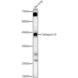 Cathepsin D (CTSD) Antibody