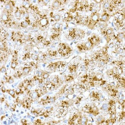 Cathepsin D (CTSD) Antibody
