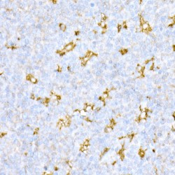 Cathepsin D (CTSD) Antibody