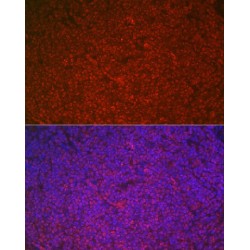 Protein C-Ets-1 (ETS1) Antibody