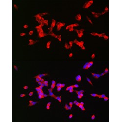 Muscarinic Acetylcholine Receptor M1 (CHRM1) Antibody