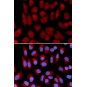 Immunofluorescence analysis of U2OS cells using TAP2 Antibody