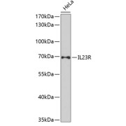 Western blot analysis of extracts of HeLa cells using IL23R Antibody (1/1000 dilution).