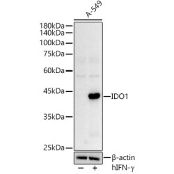 Indoleamine 2,3-Dioxygenase 1 (INDO) Antibody