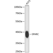 Western blot analysis of extracts of A375 cells using SPARC Antibody (1/3000 dilution).