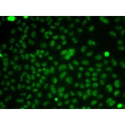 Immunofluorescence analysis of HeLa cells using CSNK2A2 Antibody