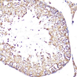 L-Selectin / CD62L (SELL) Antibody