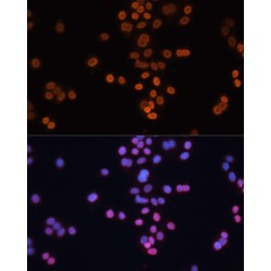 Homeobox Protein CDX-2 (CDX2) Antibody