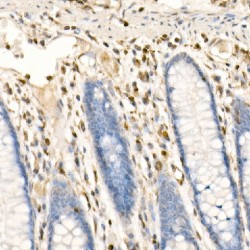 Protein S100-A4 (S100A4) Antibody