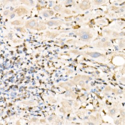 Protein S100-A4 (S100A4) Antibody