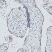 Immunohistochemistry of paraffin-embedded Human placenta using DTNBP1 Antibody (1/100 dilution, 40x lens).