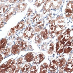 Dystrobrevin Binding Protein 1 (DTNBP1) Antibody