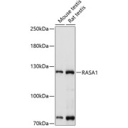 Western blot analysis of extracts of various cell lines using RASA1 Antibody (1/1000 dilution).