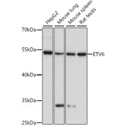 Western blot analysis of extracts of various cell lines using ETV6 Antibody (1/1000 dilution).