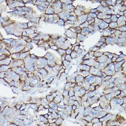 Catenin Delta 1 (CTNND1) Antibody