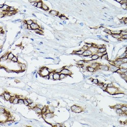 Catenin Delta 1 (CTNND1) Antibody