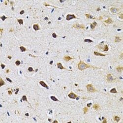 Adrenergic Receptor Beta Kinase 1 (ADRBK1) Antibody