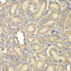 Myelin Basic Protein (MBP) Antibody