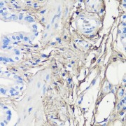 Immunohistochemistry of paraffin-embedded Rat lung using Decorin Antibody (1/200 dilution, 40x lens).