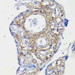 Decorin (DCN) Antibody
