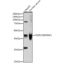 Pigment Epithelium-Derived Factor / PEDF (SERPINF1) Antibody