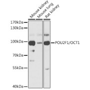 abx001413