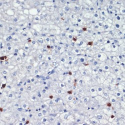 Protein S100-A8 / CAGA (S100A8) Antibody