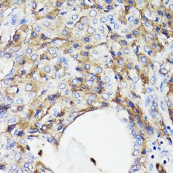 CD59 Glycoprotein (CD59) Antibody