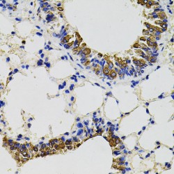 CD59 Glycoprotein (CD59) Antibody