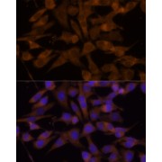 Immunofluorescence analysis of HeLa cells using UGT2B7 Antibody (1/100 dilution, 40x lens). Blue: DAPI for nuclear staining.