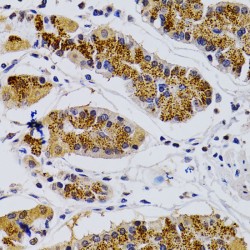 Cyclin-Dependent Kinase 7 (CDK7) Antibody