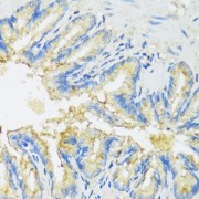 Immunohistochemistry of paraffin-embedded Rat lung using CYP11A1 Antibody (1/100 dilution, 40x lens).