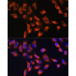 Plasma Protease C1 Inhibitor (SERPING1) Antibody
