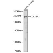 Western blot analysis of extracts of Mouse lung using COL18A1 Antibody (1/1000 dilution).
